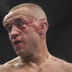 Illustration for article titled A Canadian Ultimate Fighters Head Resembled The Elephant Man By The Time UFC 129 Was Over